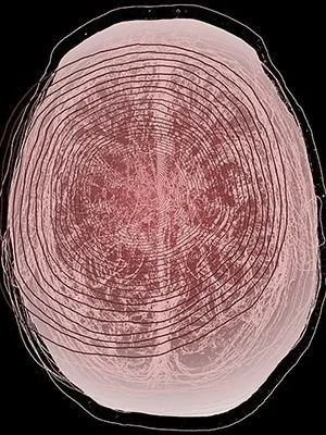 Episode 4: Wellbeing Requires a Balance of Silence and Noise