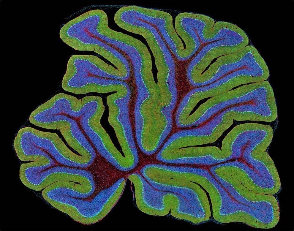 Beau Discusses The Effects Of Travel On The Brain For Vox News