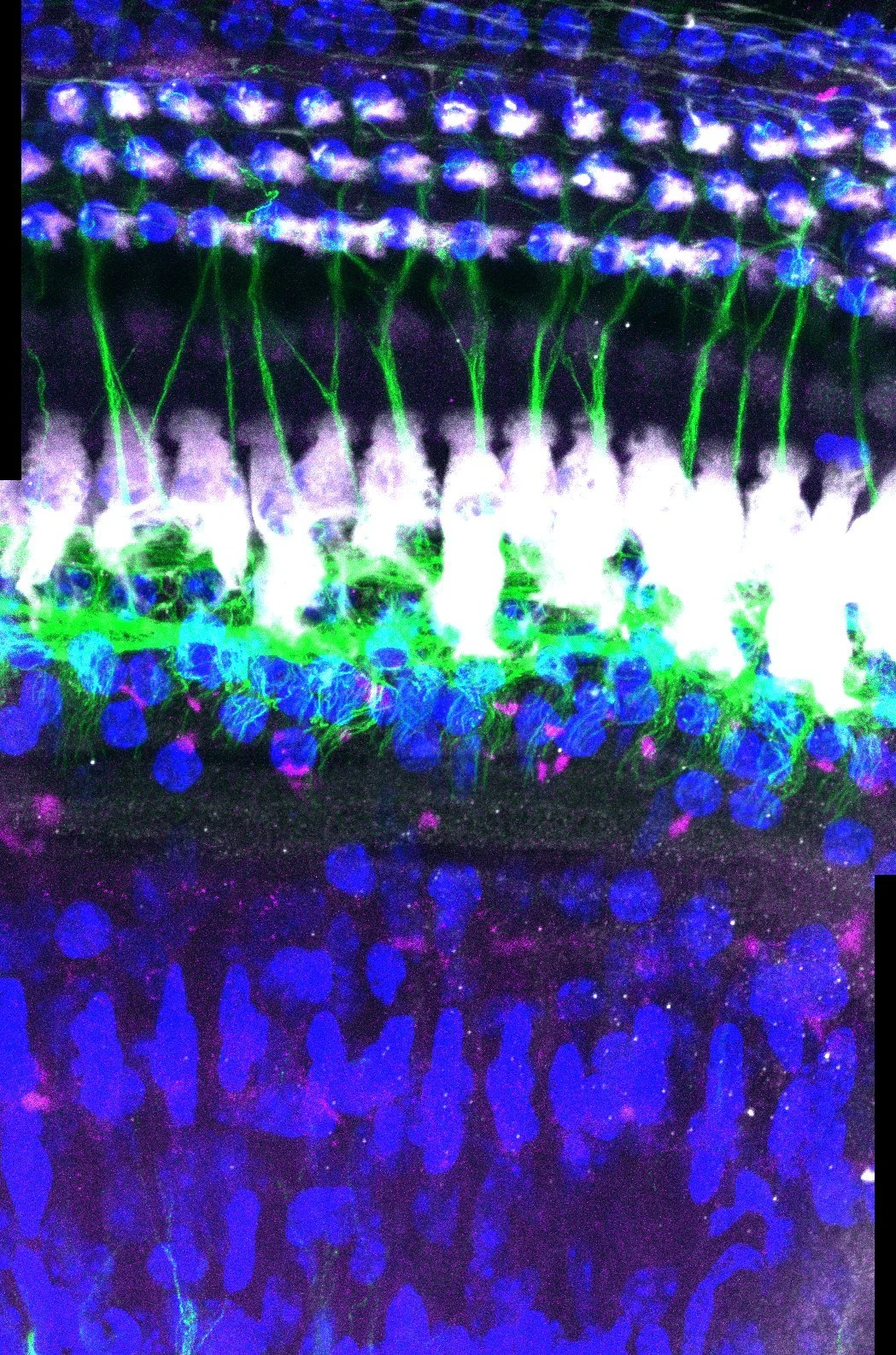 Neuronal Labeling in the Organ of Corti