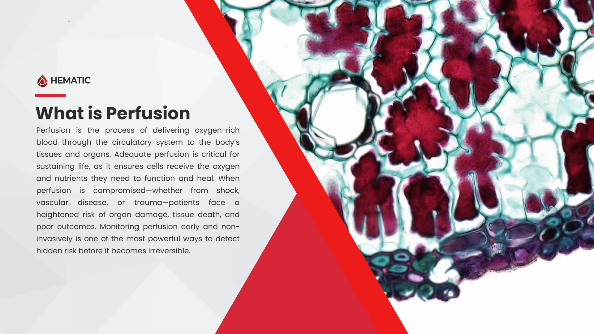 WhatIsPerfusion.png