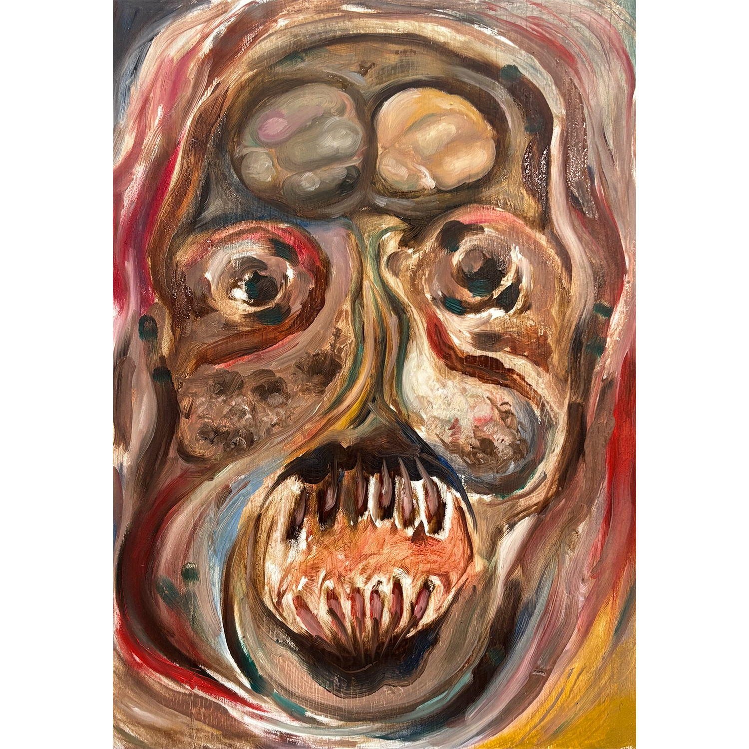 Study of MRI Scan #1