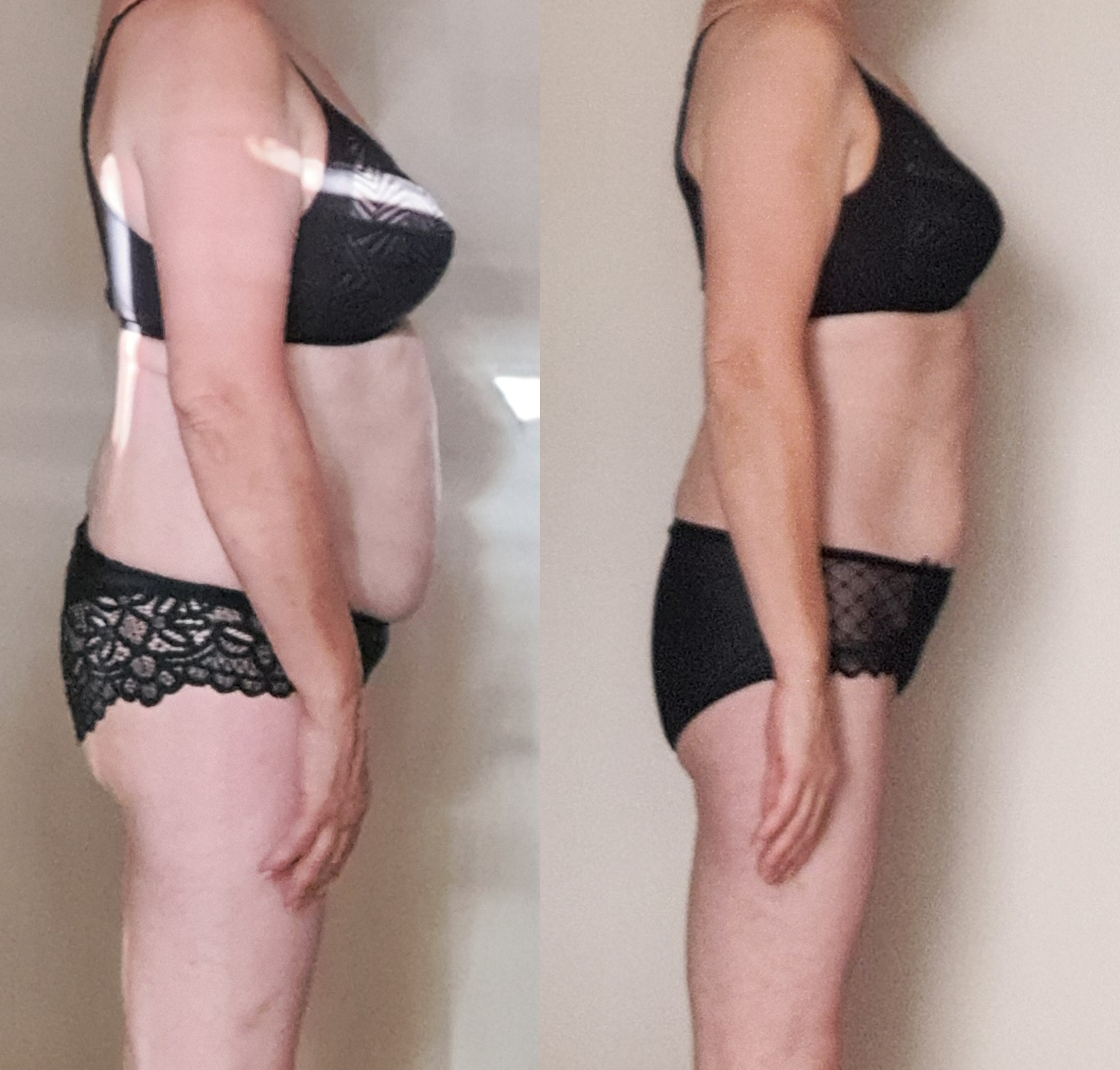 Transformation corporelle d'une femme, montrant un avant et un après d'une perte de poids, portant des sous-vêtements noirs avec des motifs en dentelle.