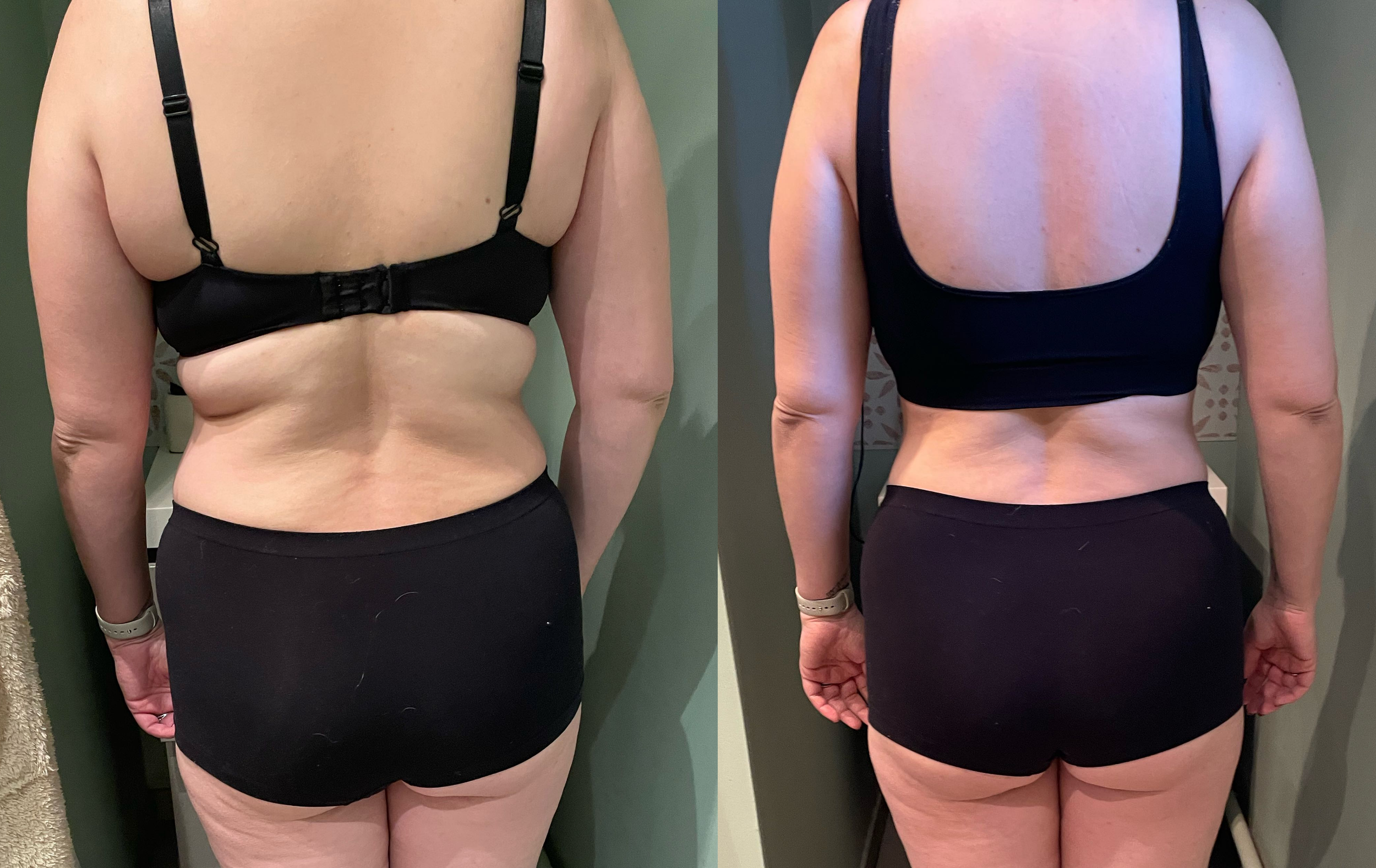Comparaison avant et après d'une femme montrant une réduction de poids ou d'amélioration de la silhouette, vue de dos, portant un soutien-gorge noir et un short noir, dans un contexte intérieur.