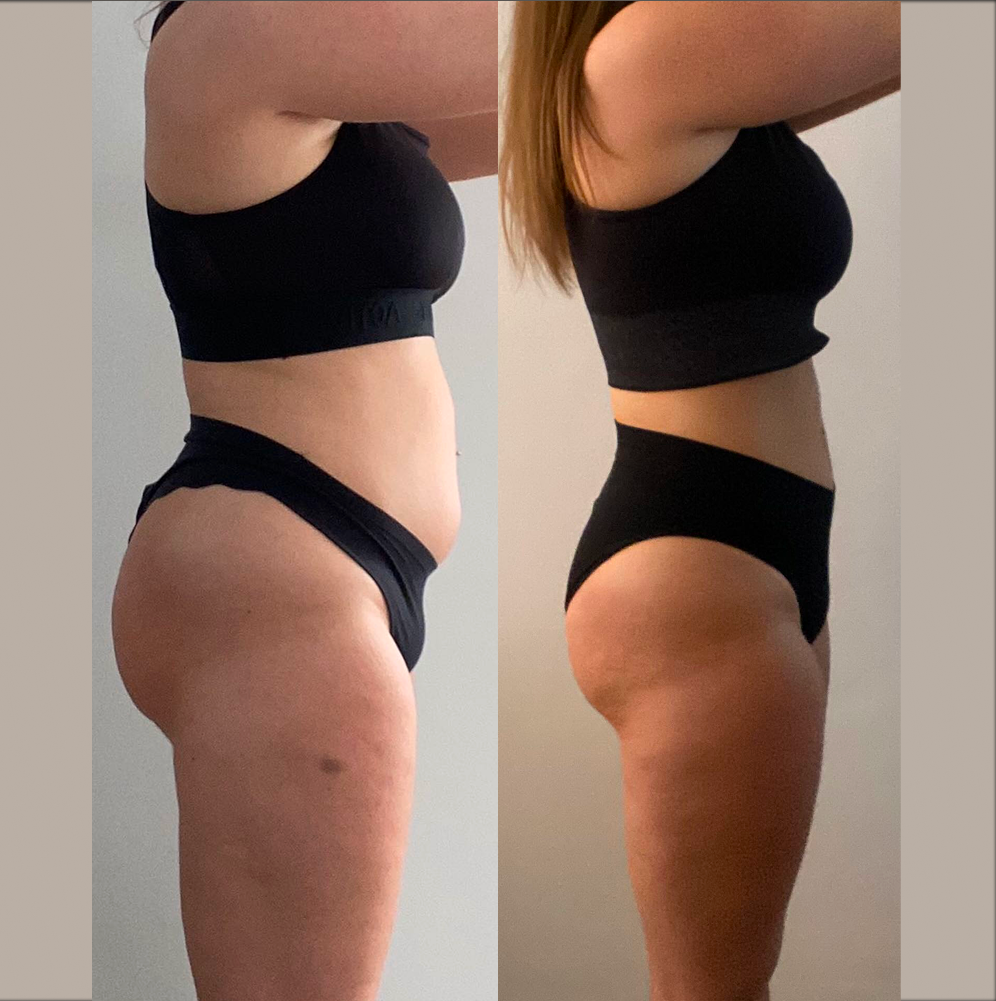 Comparaison avant et après d'une femme montrant sa silhouette en profil, portant un haut noir et un sous-vêtement noir, illustrant une perte de poids et de tonification musculaire.
