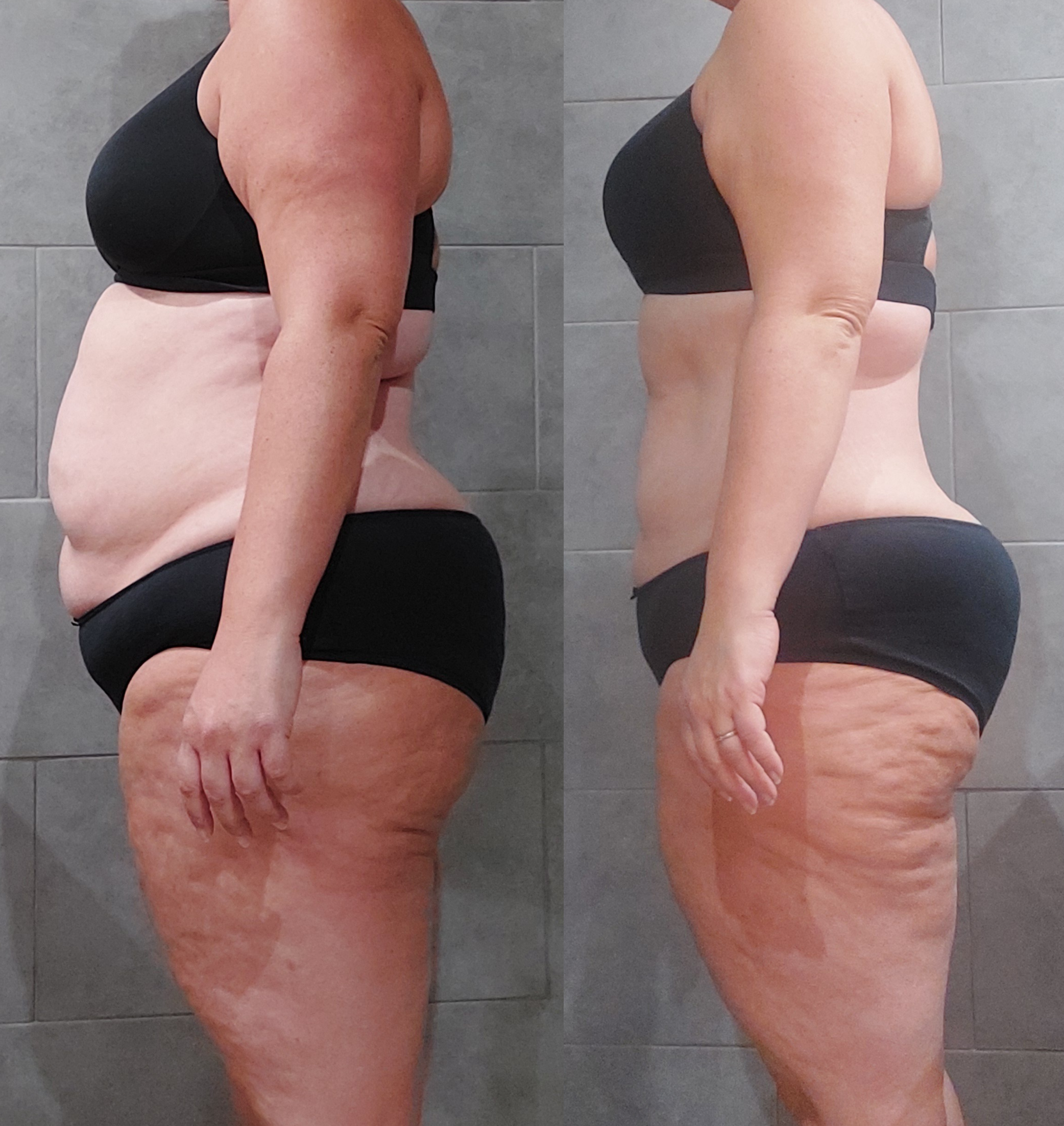 Photo montrant une femme avant et après une transformation corporelle, en vêtements noirs, debout de profil contre un mur gris.