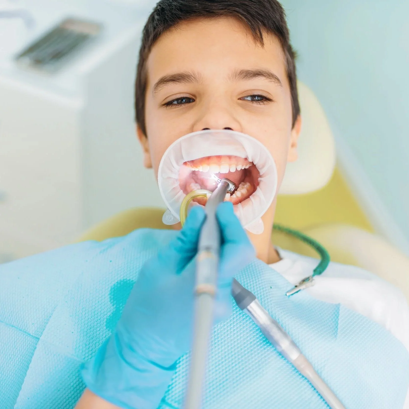 caries-removal-procedure-pediatric-dentistry-2024-12-05-13-55-22-utc.jpg