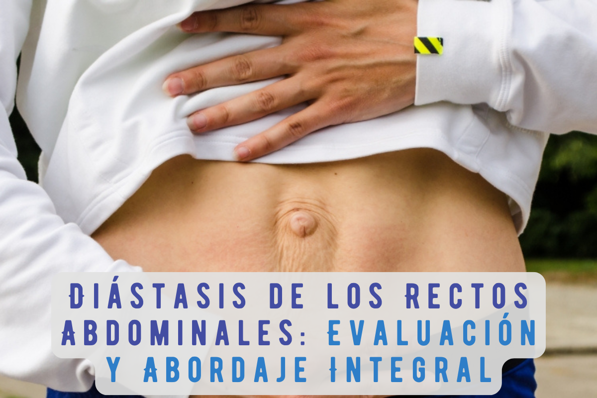 Diástasis de los Rectos Abdominales: Evaluación y Abordaje Integral desde la Terapia Manual y el Ejercicio Terapéutico
