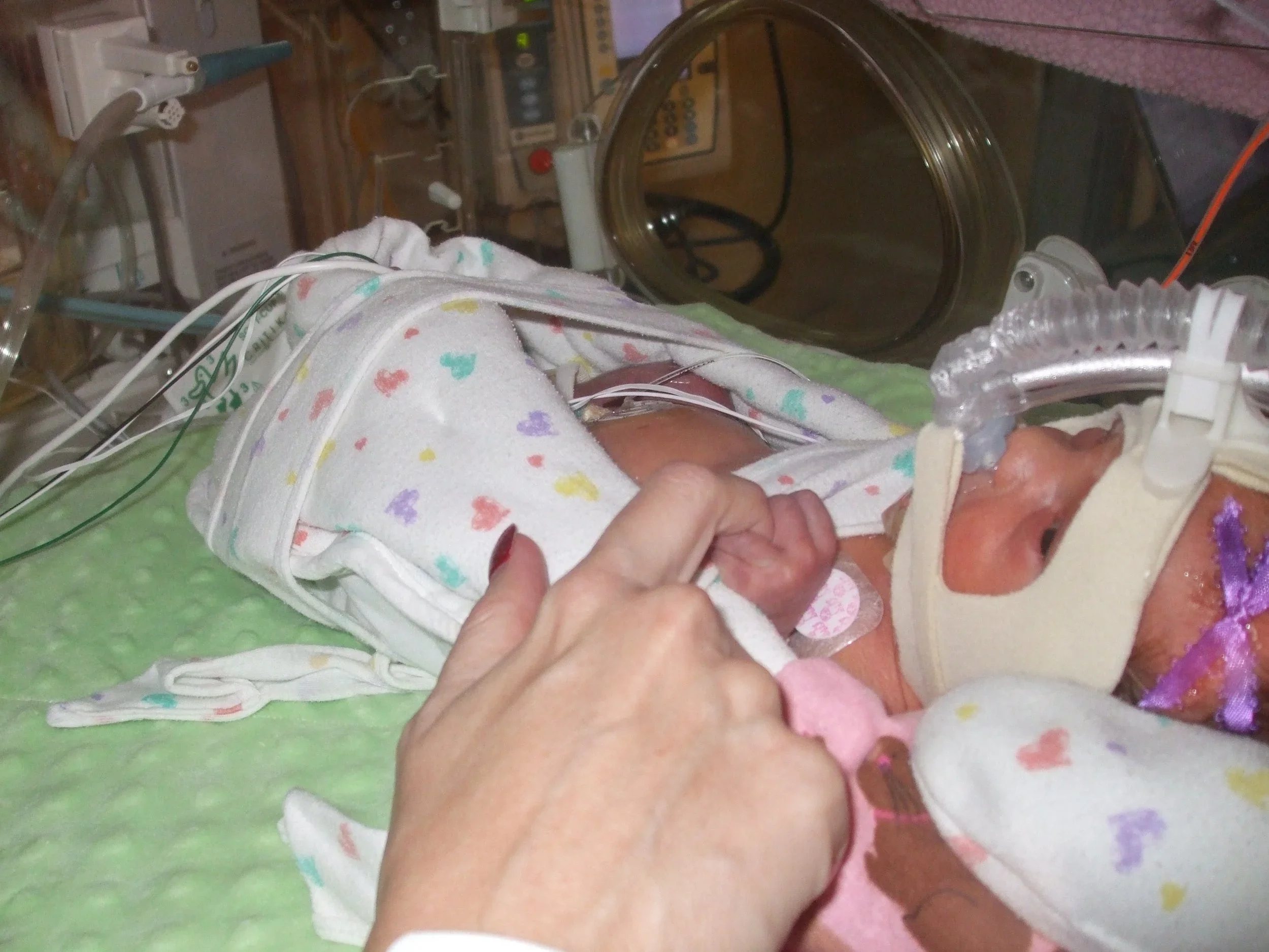 The NICU: Lauren’s fight for survival