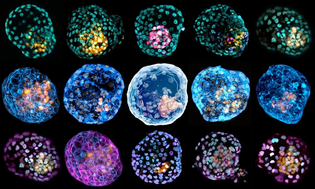 Embryos are being created from human skin cells