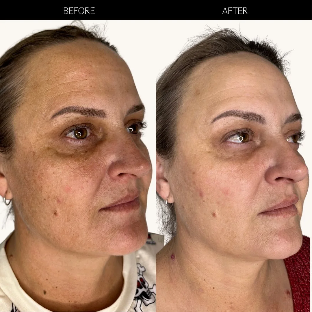 Clients that put their trust in you 😍

The goal? You, just refreshed. Every single time. 

Nothing like your clients feeling more confident in themselves and happier to live their daily lives without feeling the NEED to wear makeup, what an accompli