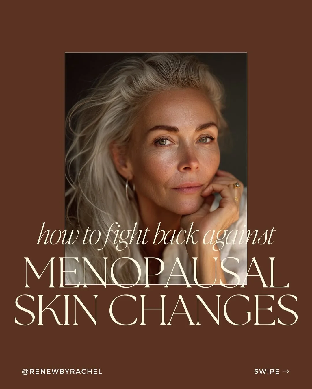 Menopause + skin: the connection we don&rsquo;t talk about enough. 💜 Swipe to uncover the science + simple ways to restore balance

#cosmeticnursegunnedah #cosmeticnurse #renewbyrachelgunnedah #renewbyrachel #menopause #menopauseskin #skingunnedah