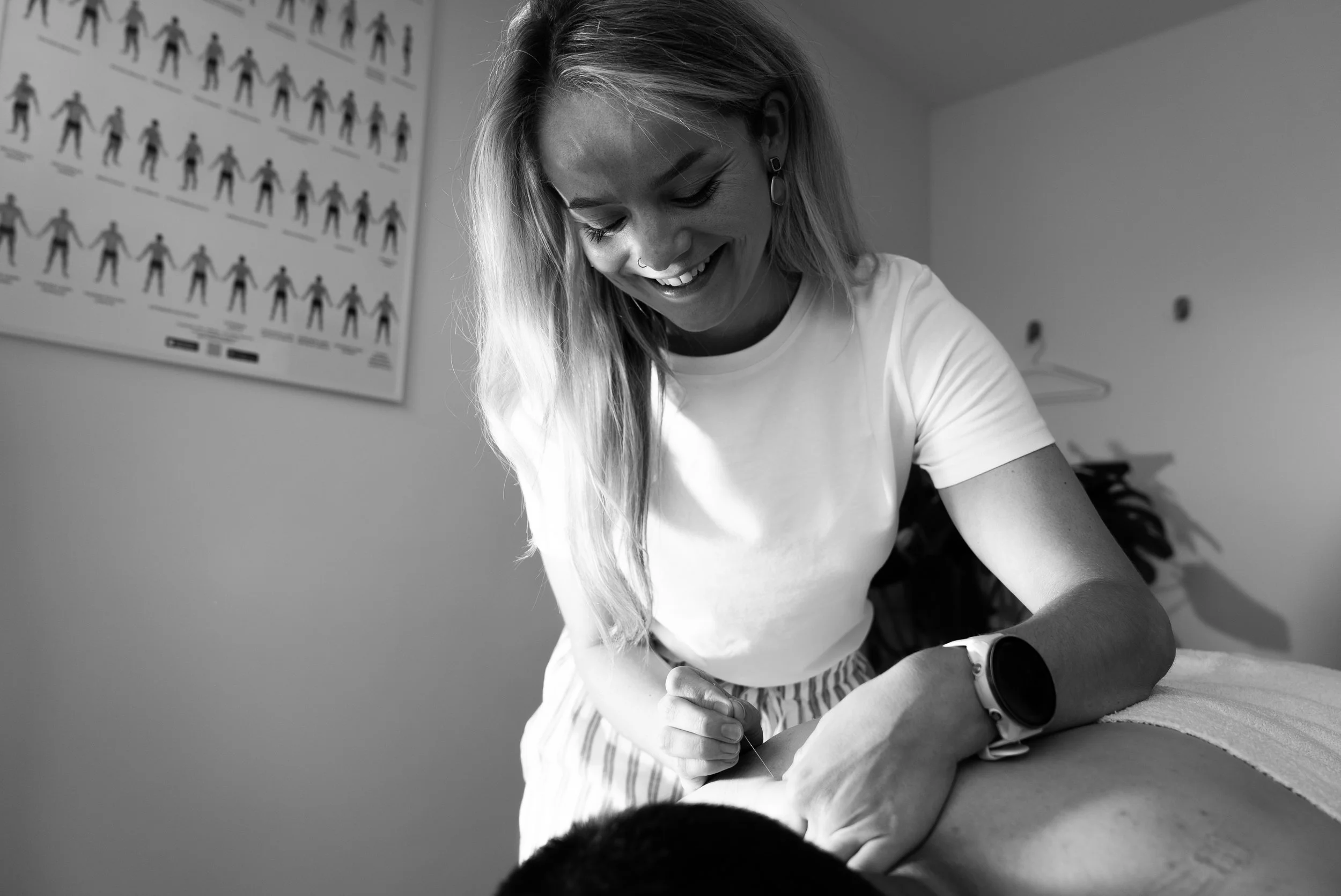 Vrouw die acupunctuurbehandeling geeft aan een persoon op een tafel, lachend in een kliniek met een anatomieposter op de muur.