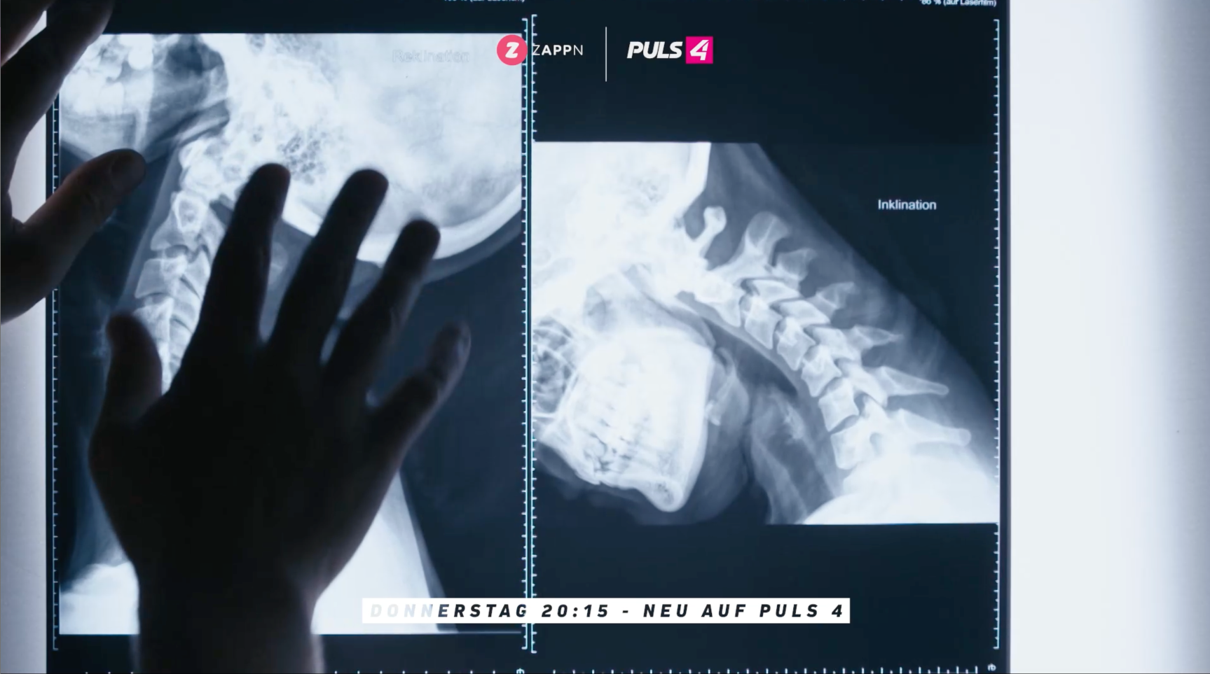 Röntgenbilder eines menschlichen Schädels und Halswirbelsäule, die auf einem beleuchteten Bildschirm betrachtet werden.