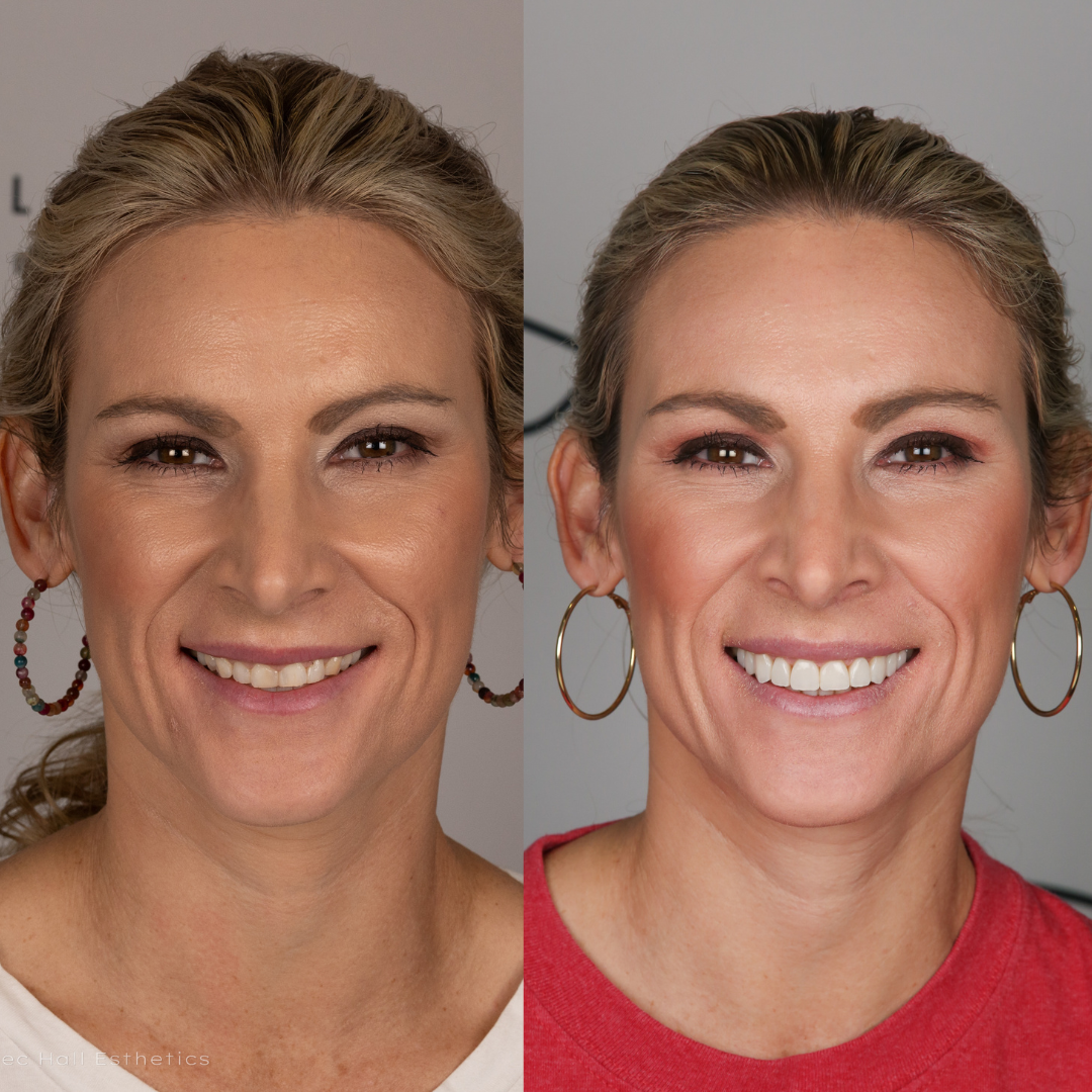 Full Face Before and After.png