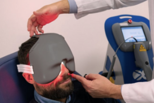 Fotobiomodulación Macular CDMX