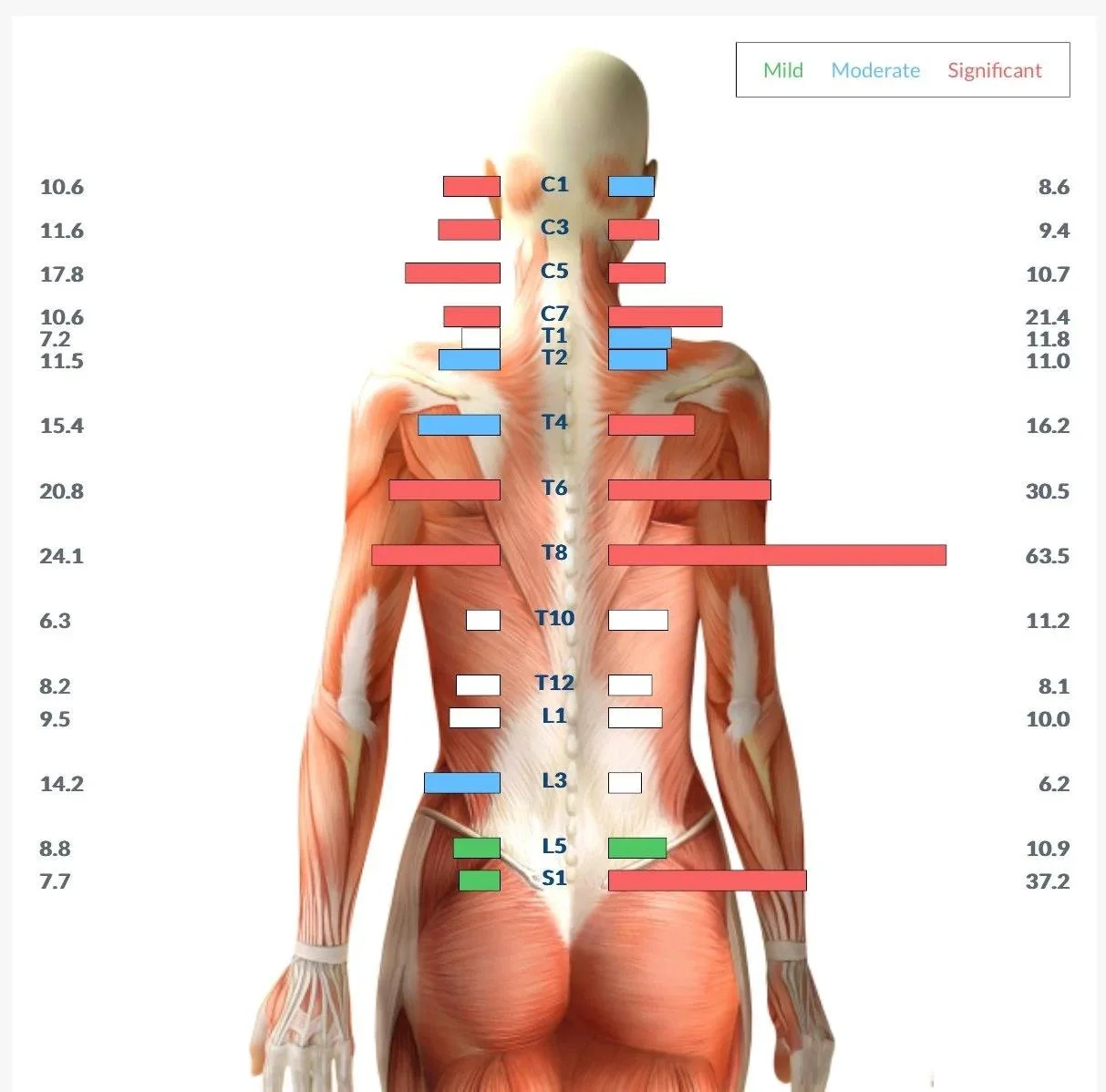 Muscle tension scan chart showing measurements along the cervical, thoracic, lumbar, and sacral spine.
