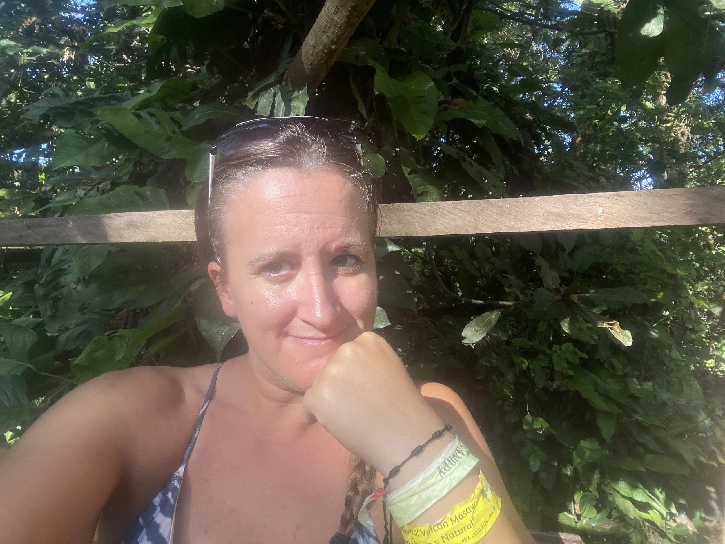 Woman resting in tropical setting in Central America after recovering from illness during travel
