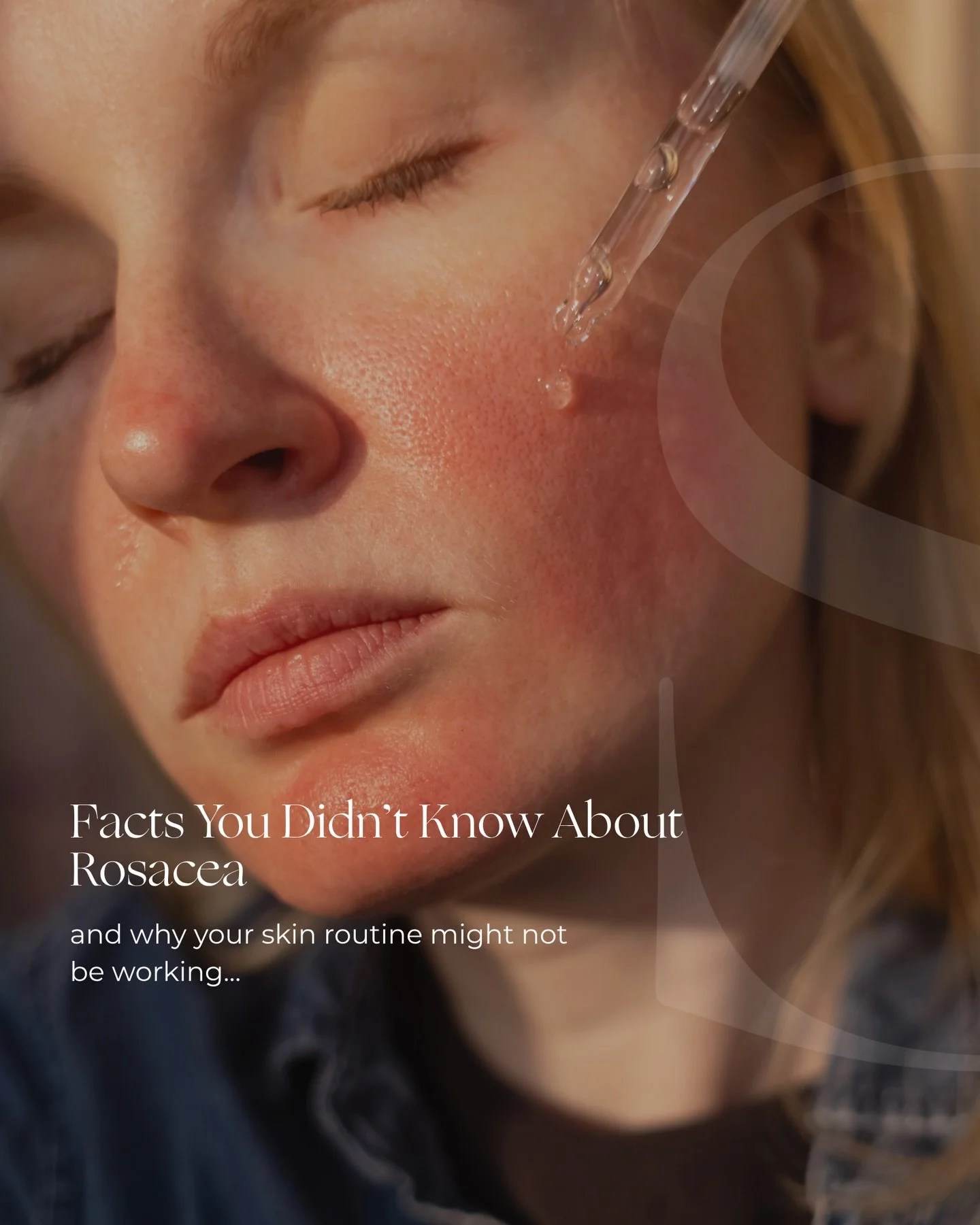 Our skin can often feel like a mystery, and for those living with rosacea, that feeling is all too familiar. The constant redness, reactivity, and unpredictability can make it difficult to understand what your skin actually needs.

This Rosacea Aware