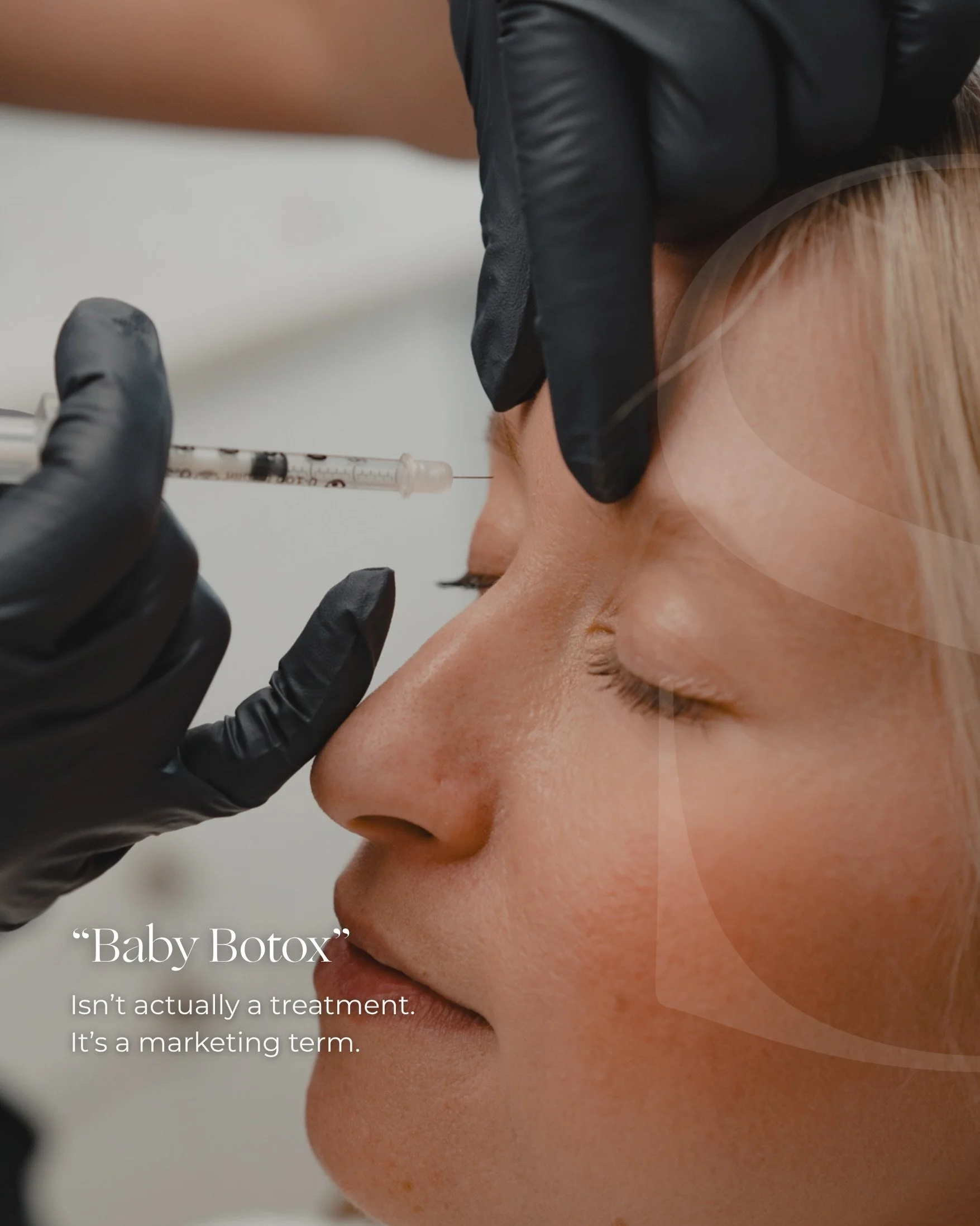 One of the biggest misconceptions we see online right now is the idea that &ldquo;baby botox&rdquo; automatically means more natural results.

But neuromodulators were never designed to be one-size-fits-all.

Your dose shouldn&rsquo;t be based on a t