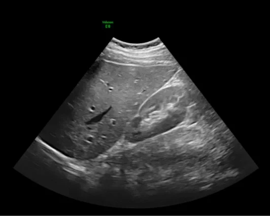 Diagnostic abdominal ultrasound exam being performed in a Saskatoon medical clinic