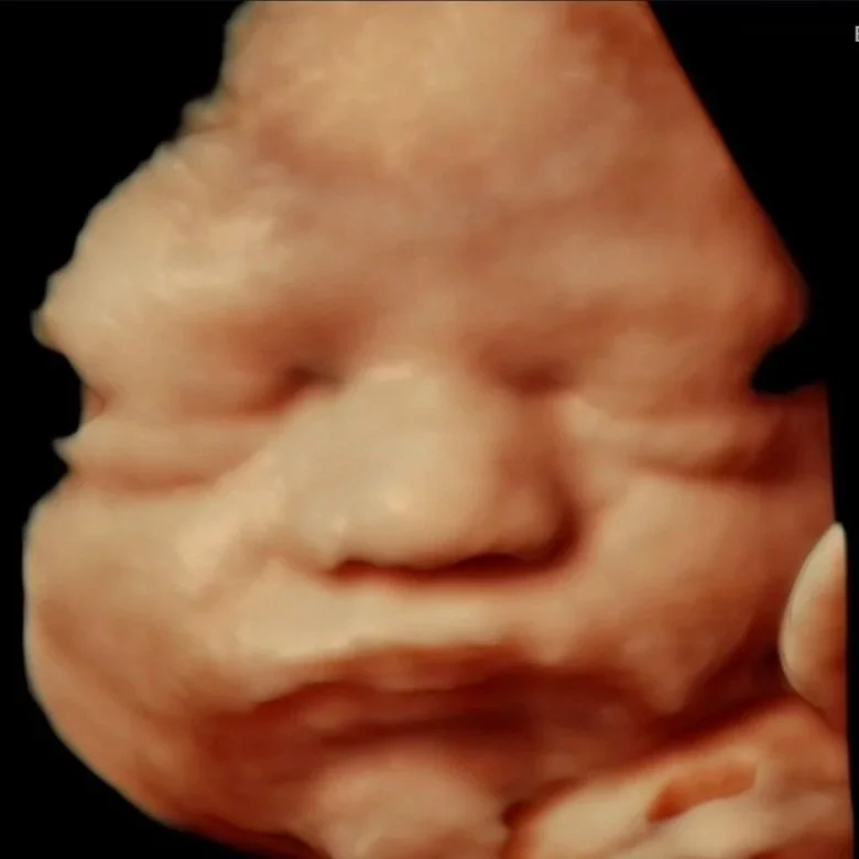 3D ultrasound image of baby at Baby Bliss Ultrasound in Houston