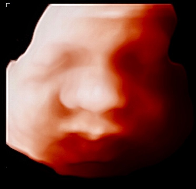 The Best Time for a 3D or 4D Ultrasound in Houston: The "Sweet Spot" Guide