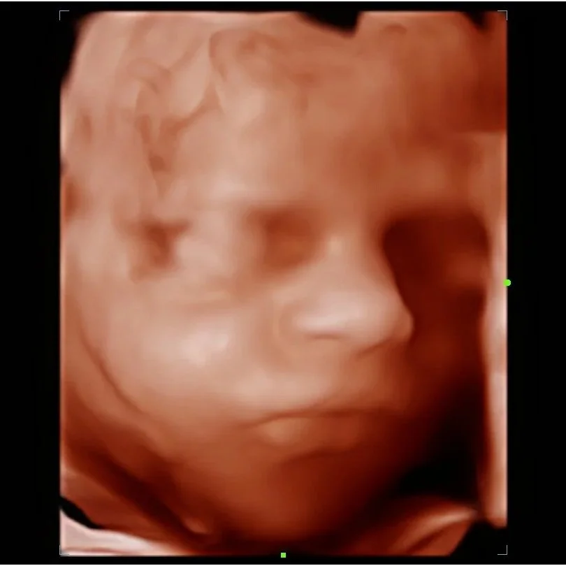 202605191255520004OB.jpg