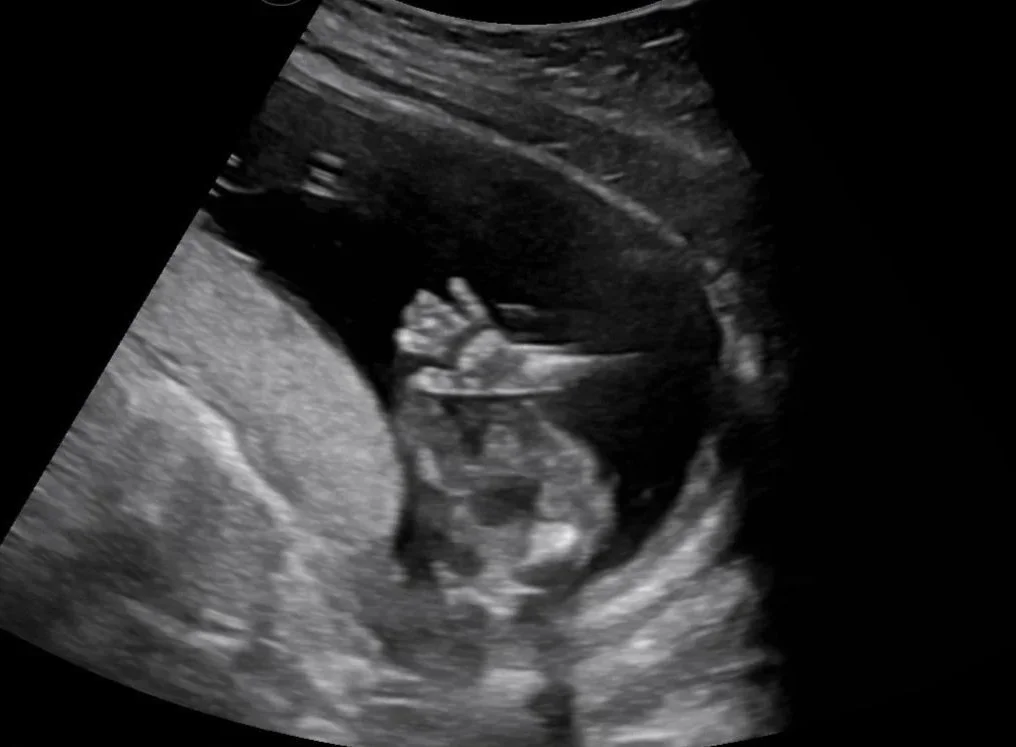 202602201041160023OB.jpg