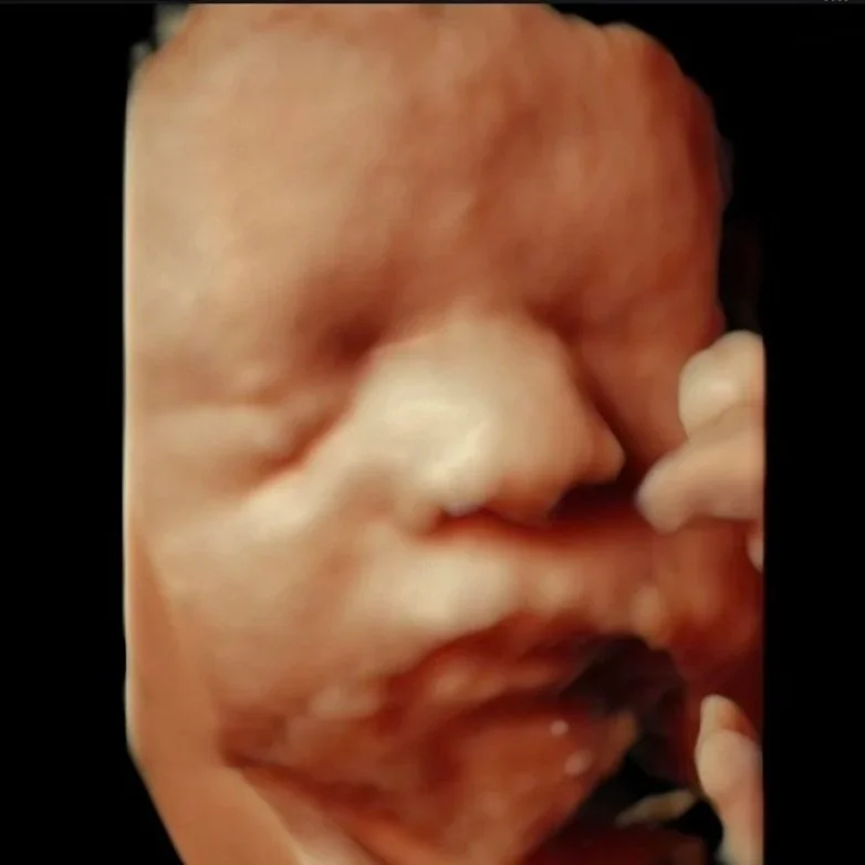 Clear 3D ultrasound image capturing baby’s facial features during a keepsake ultrasound session at Baby Bliss Ultrasound in Houston, TX.