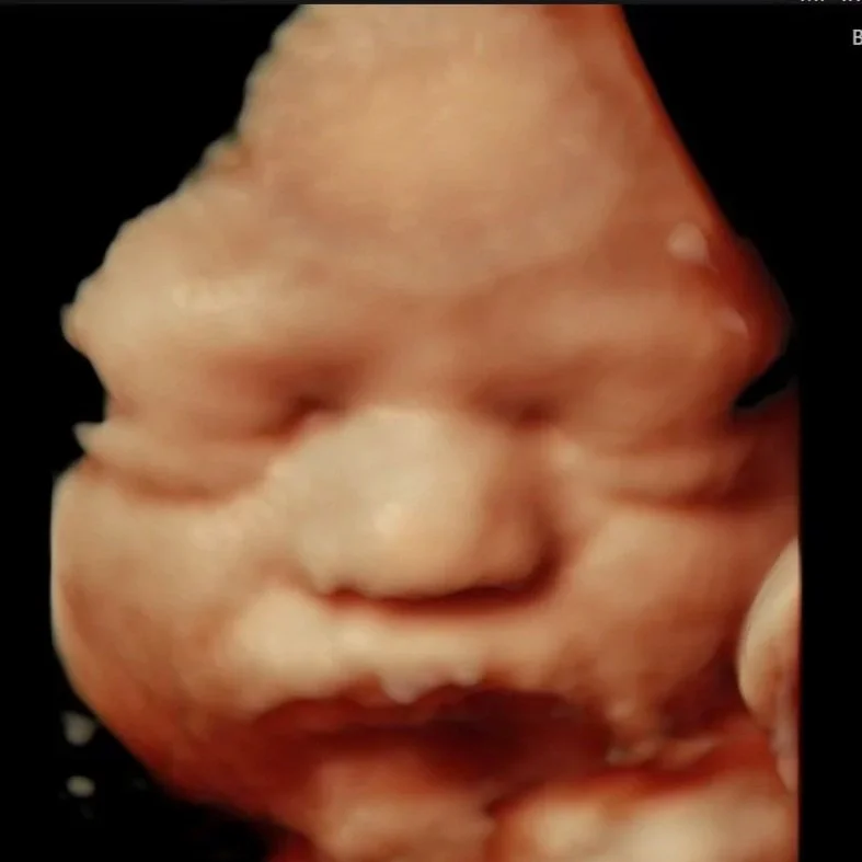 Beautiful HD Live ultrasound image offering a detailed, lifelike view of baby’s face during a 3D/4D ultrasound experience in Houston.