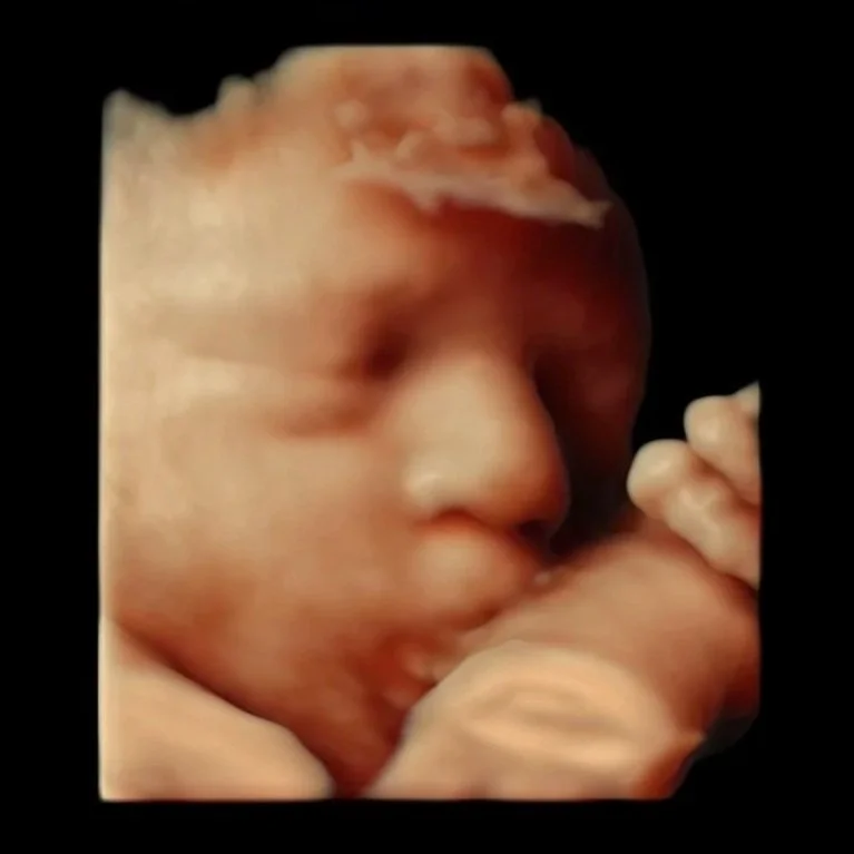 Sweet 3D/4D ultrasound view of baby captured during a private elective ultrasound session near Downtown Houston.