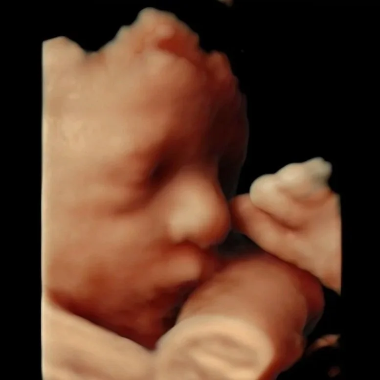 Detailed 3D and HD Live ultrasound imaging helps families get a beautiful glimpse of baby’s features before birth.