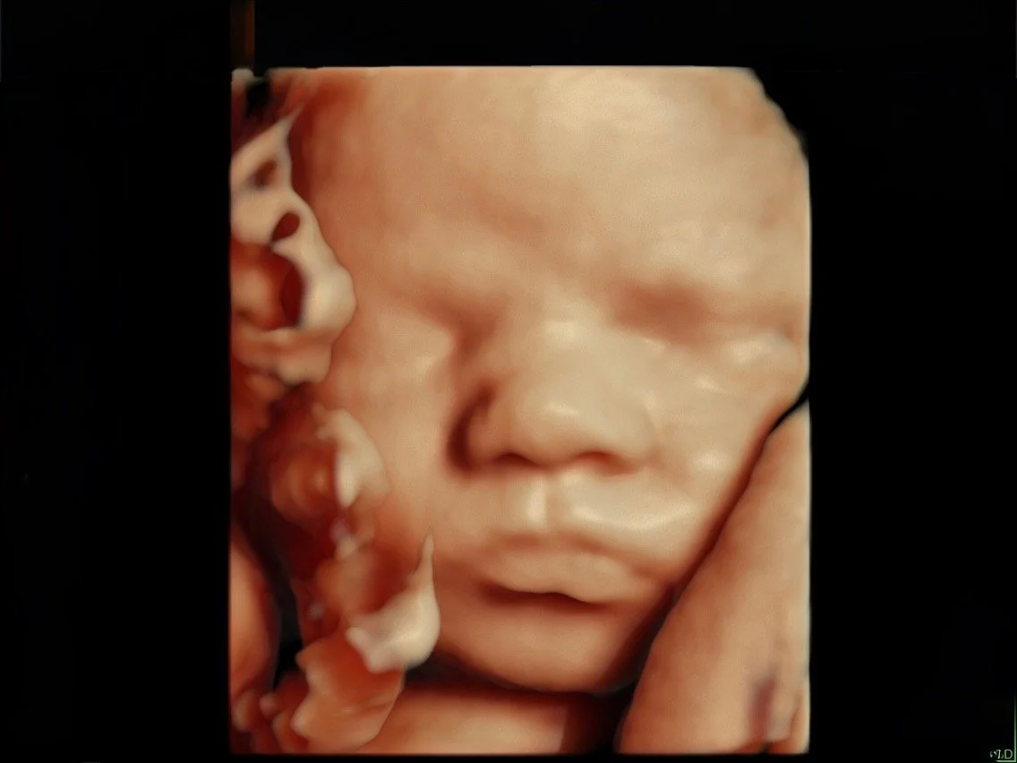 HD Live 3D/4D pregnancy ultrasound showing baby's facial features at Baby Bliss Ultrasound in Houston, TX