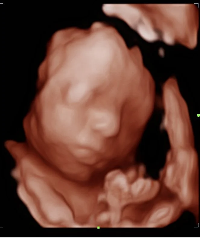 202512121400510021OB.jpg