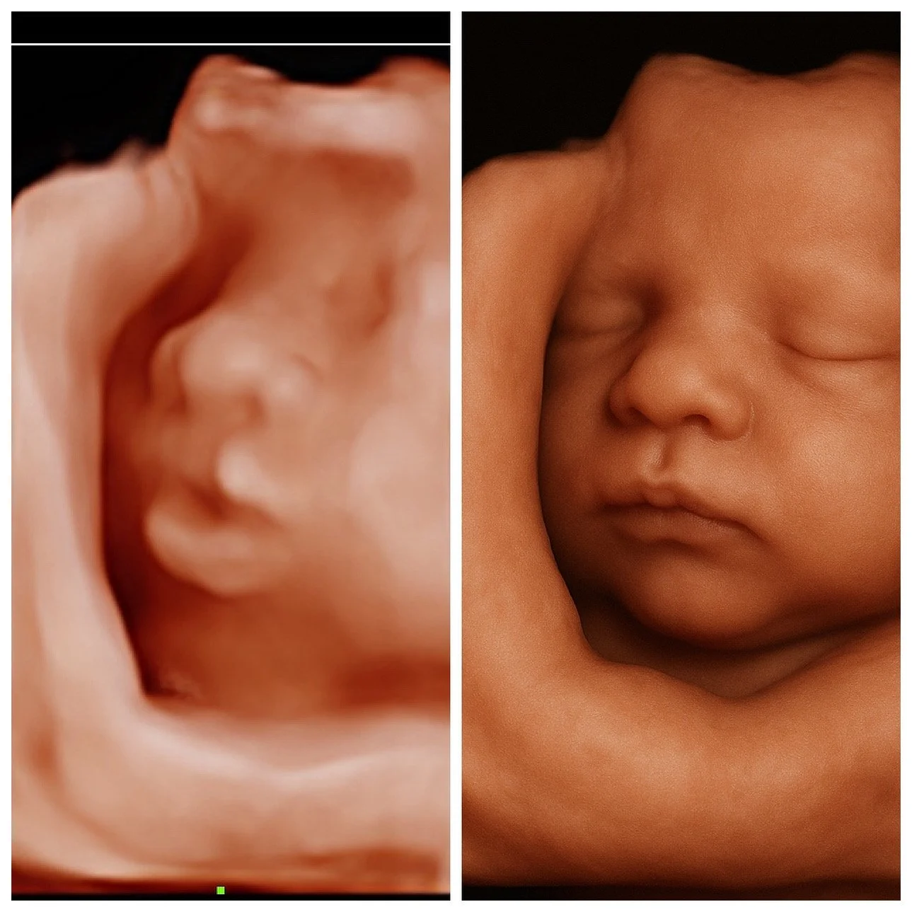 3D/4D Ultrasound Houston - 8k image done at Baby Bliss Imaging Houston