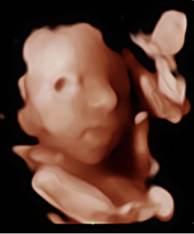 202512121356110003OB.jpg