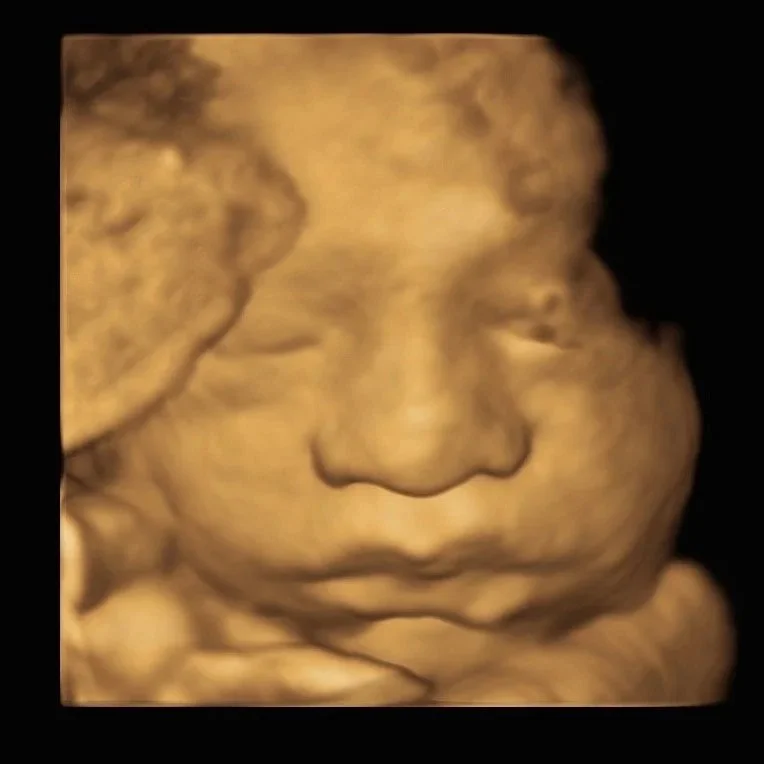 baby-bliss-ultrasound-3d-baby-image.jpg