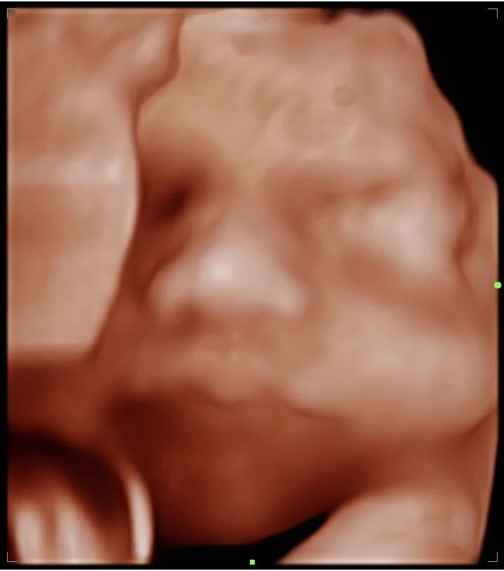 202605111909580084OB.jpg