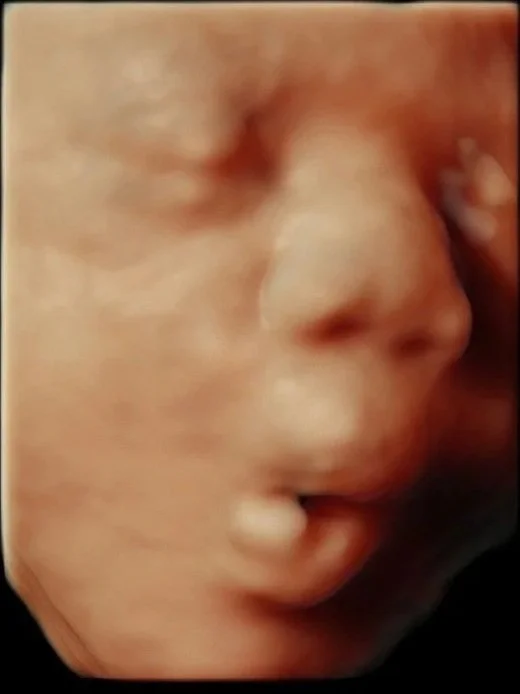 3D ultrasound image of baby at Baby Bliss Ultrasound in Houston, TX