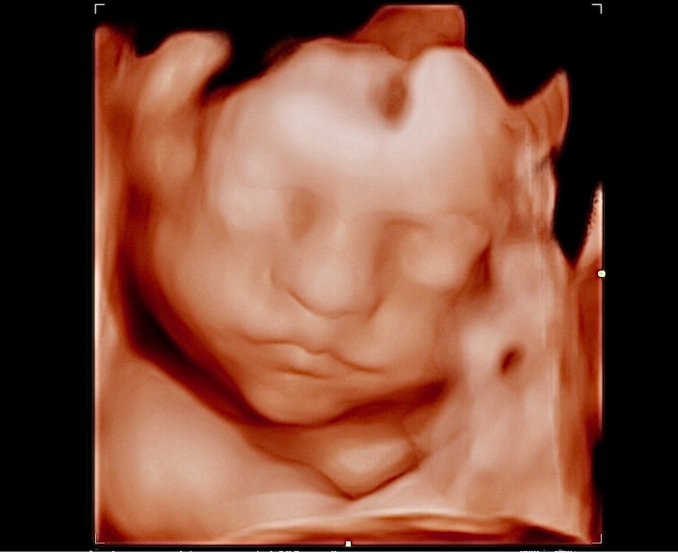 Baby Bliss Ultrasound Houston_2.jpeg