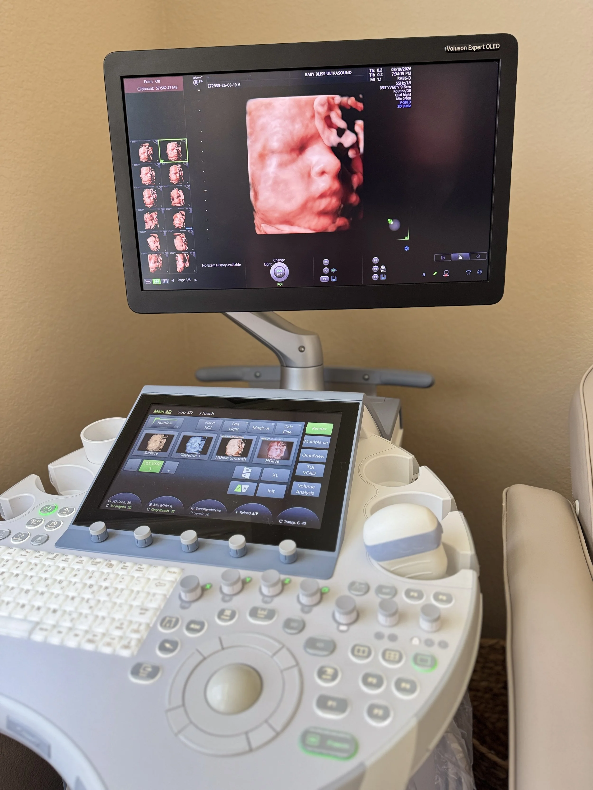 HD Live baby ultrasound image displayed on GE Voluson E10 ultrasound technology at Baby Bliss Ultrasound Houston.