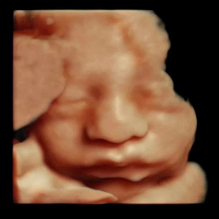baby-bliss-ultrasound-hd-baby-image.jpg