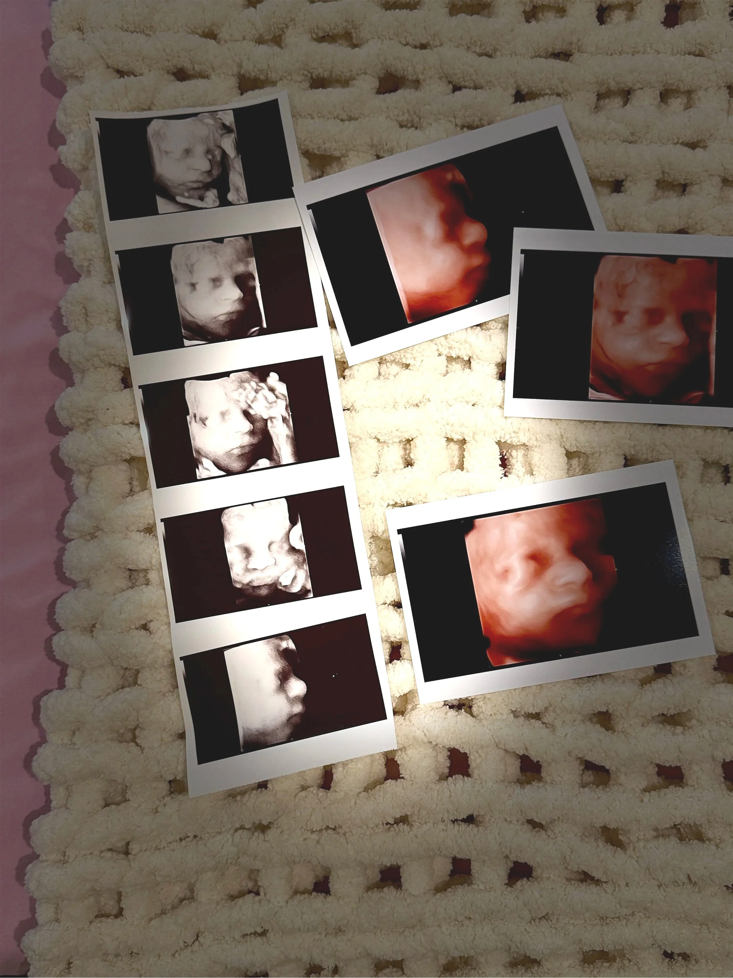Collection of 3D and 4D ultrasound images displayed on a soft blanket in Houston, Texas.