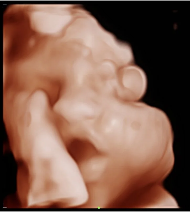 202605111848130054OB.jpg