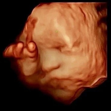 4D Ultrasound baby face scan in Houston TX - Baby Bliss