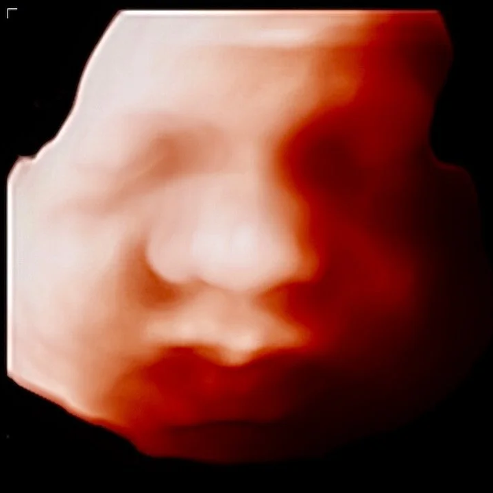 HD Live 5D Ultrasound realistic baby imaging Houston