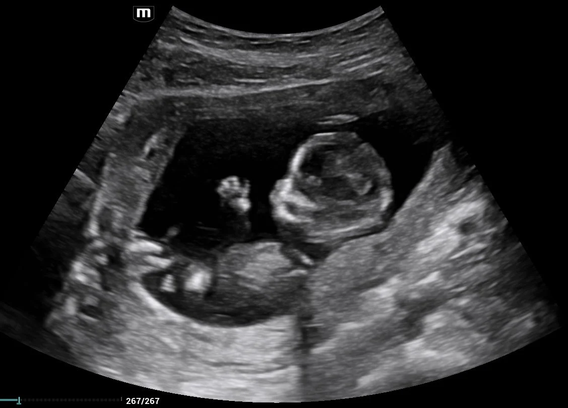 202605171405540007OB.jpg