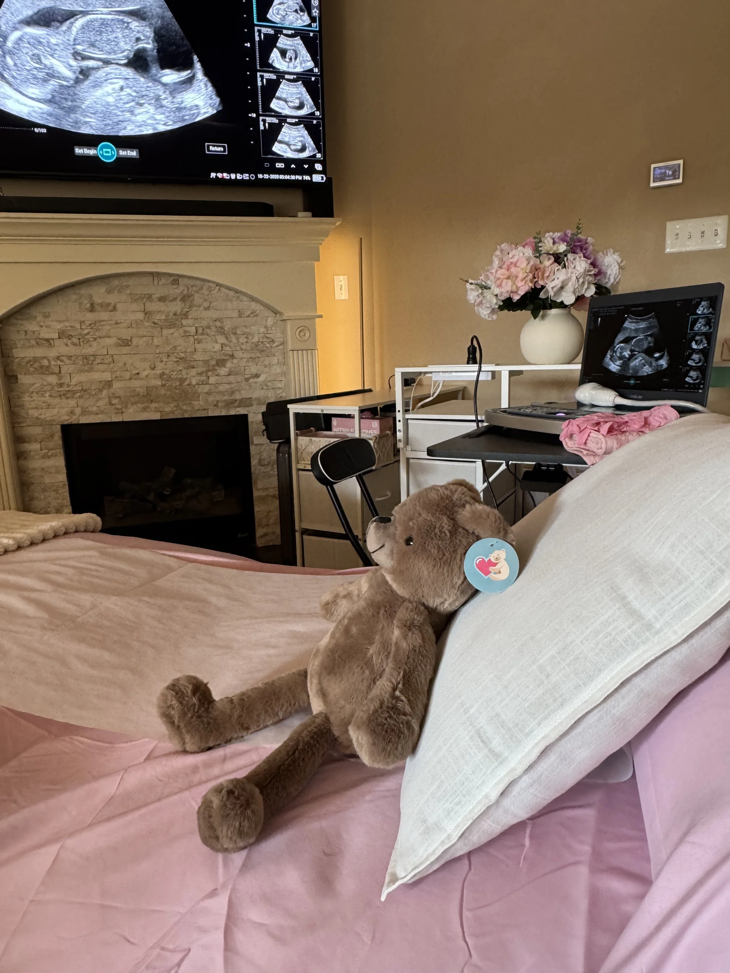 Heartbeat animal at Baby Bliss Imaging Houston 3D/4D ultrasound studio