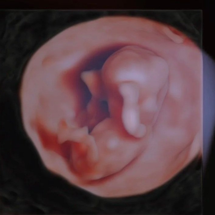 9-week first trimester baby shown in 3D, 4D and HD Live ultrasound in Houston, TX