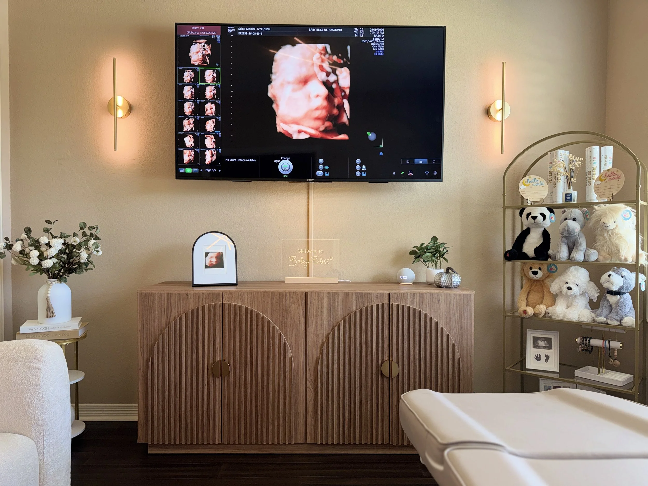 HD Live baby ultrasound displayed on the TV during a boutique ultrasound session at Baby Bliss Ultrasound in Houston.